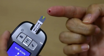 Médico alerta para o risco de pé diabético em pacientes